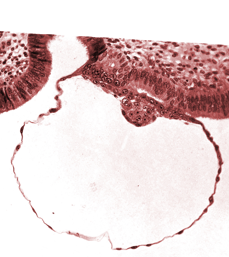 blastocystic cavity (blastocoele), contact area(s), cytotrophoblast, embryonic disc, gap in contact area, mural trophoblast, syncytiotrophoblast