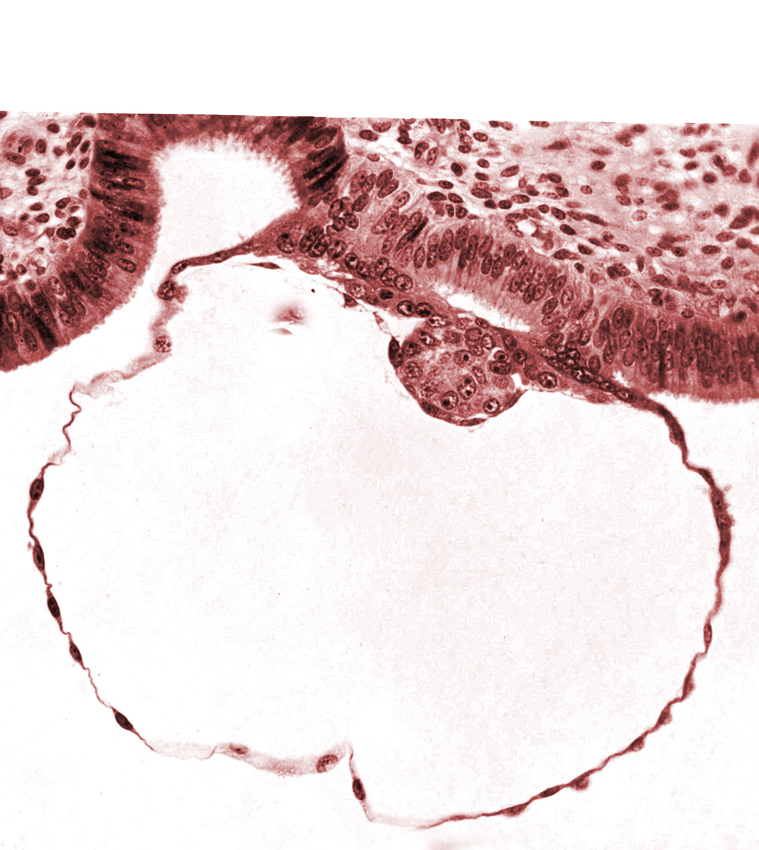 blastocystic cavity (blastocoele), epiblast, gap in contact area, hypoblast, mural trophoblast, syncytiotrophoblast