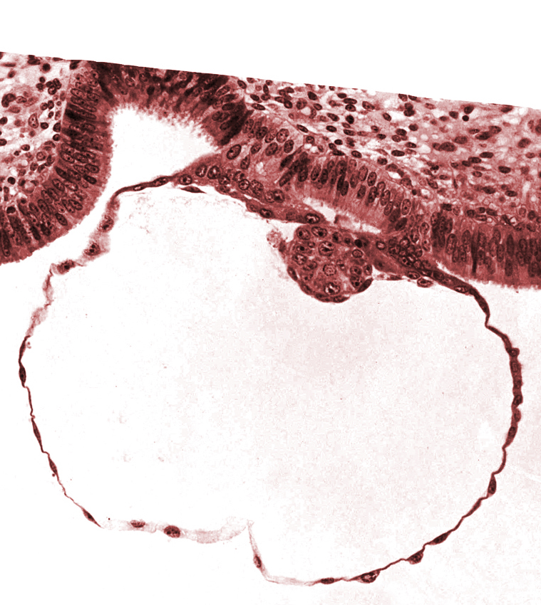 blastocystic cavity (blastocoele), cytotrophoblast, epiblast, gap in contact area, hypoblast, mural trophoblast, syncytiotrophoblast, uterine cavity