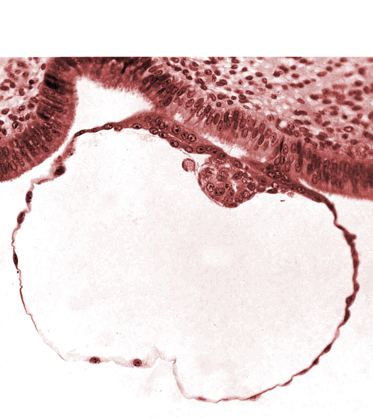 amniogenic cell, blastocystic cavity (blastocoele), contact area(s), cytotrophoblast, epiblast, gap in contact area, hypoblast, mural trophoblast, primordium of amniotic cavity, syncytiotrophoblast