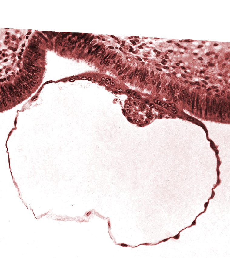 blastocystic cavity (blastocoele), contact area(s), embryonic disc, mural trophoblast, primordium of amniotic cavity