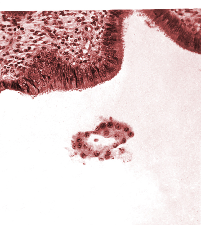 blastocystic cavity (blastocoele), tangentially cut mural trophoblast