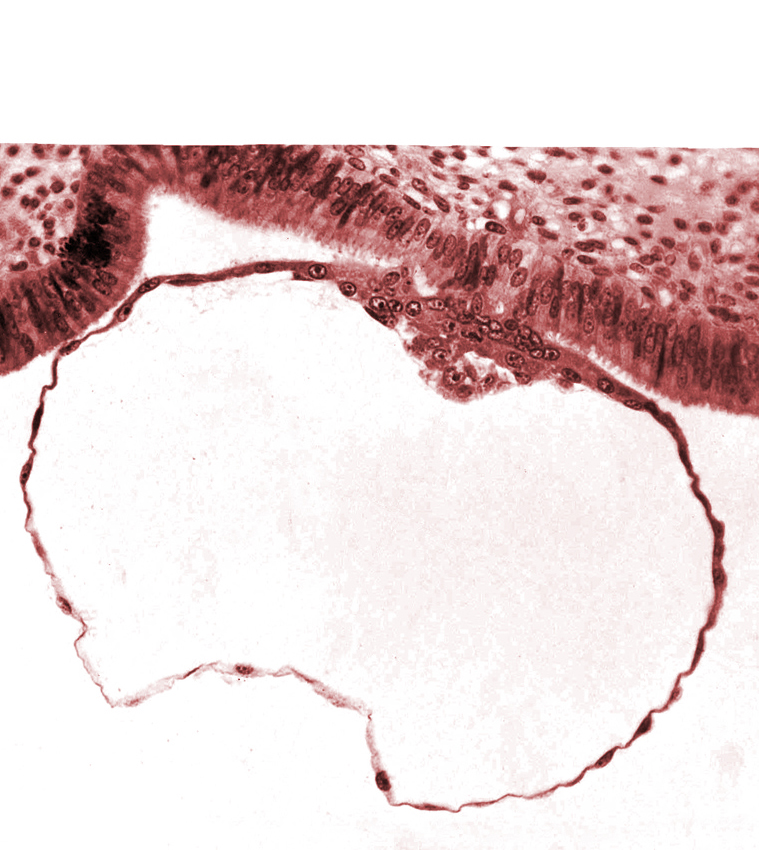 amniogenic cell, blastocystic cavity (blastocoele), edge of contact area, embryonic disc, mural trophoblast, primordium of amniotic cavity, syncytiotrophoblast