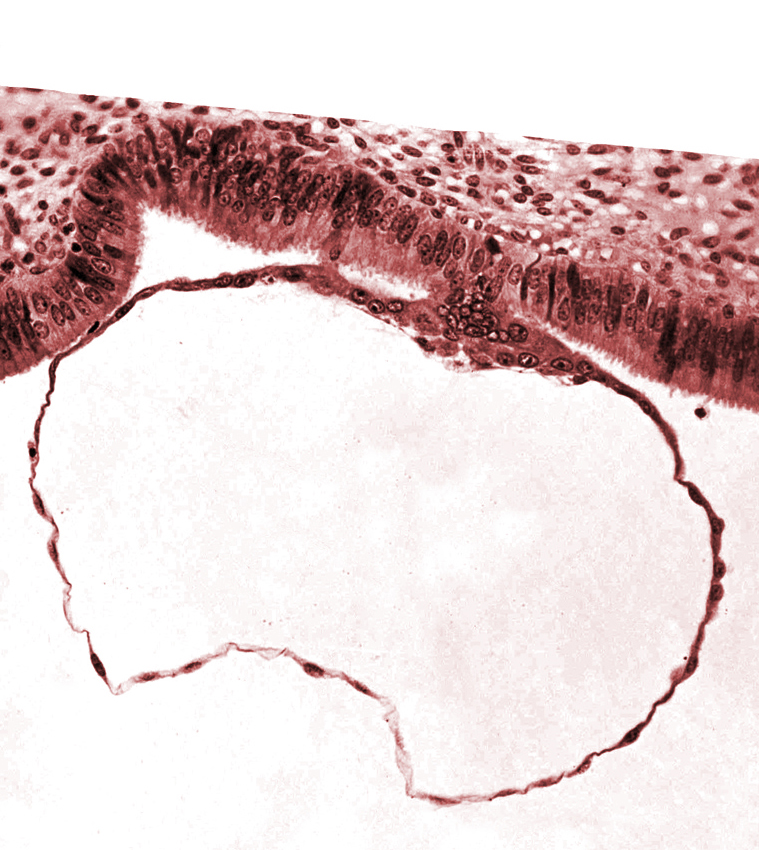 contact area(s), cytotrophoblast, edge of embryonic disc, syncytiotrophoblast nuclei