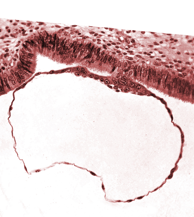 blastocystic cavity (blastocoele), cytotrophoblast nuclei, mural trophoblast