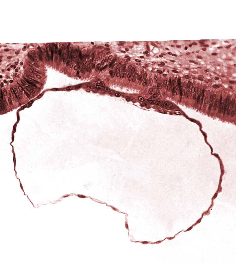 blastocystic cavity (blastocoele), contact area(s), cytotrophoblast, mural trophoblast, syncytiotrophoblast