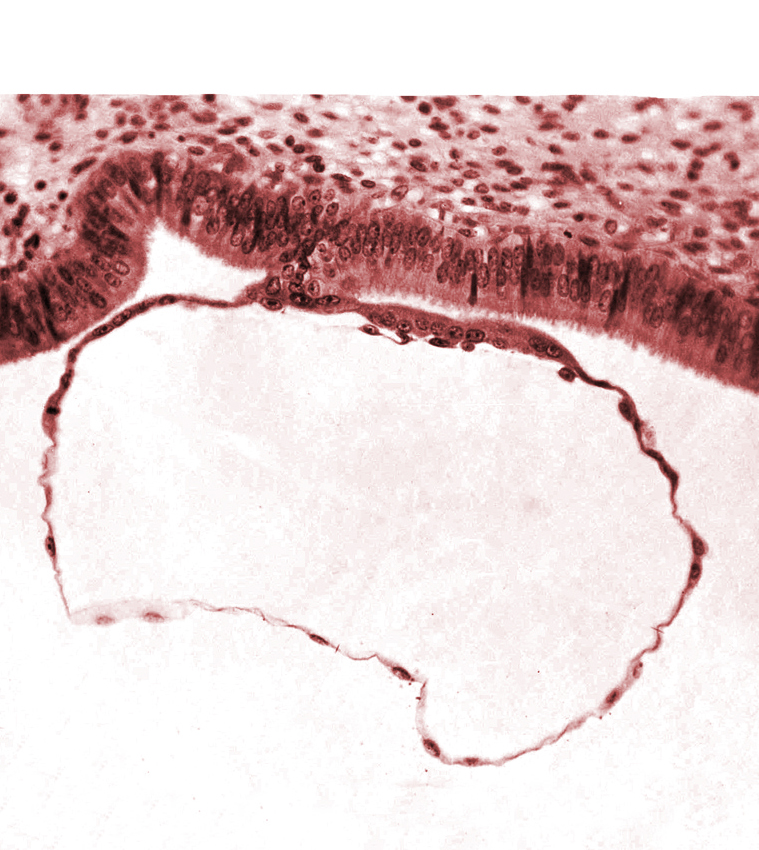 contact area(s), cytotrophoblast, mural trophoblast, syncytiotrophoblast