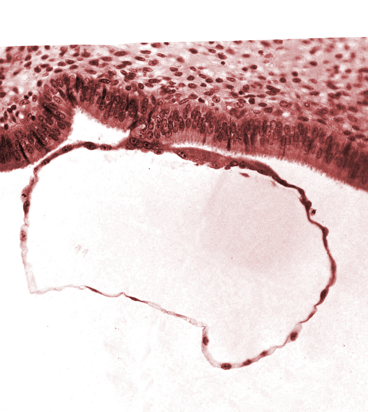 blastocystic cavity (blastocoele), contact area(s), edematous endometrial stroma (decidua), endometrial (uterine) epithelium, mural trophoblast, uterine cavity