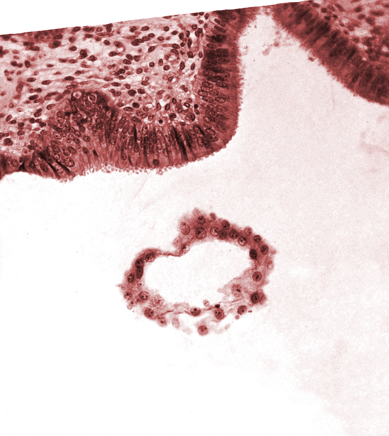 blastocystic cavity (blastocoele), tangentially cut mural trophoblast, uterine cavity