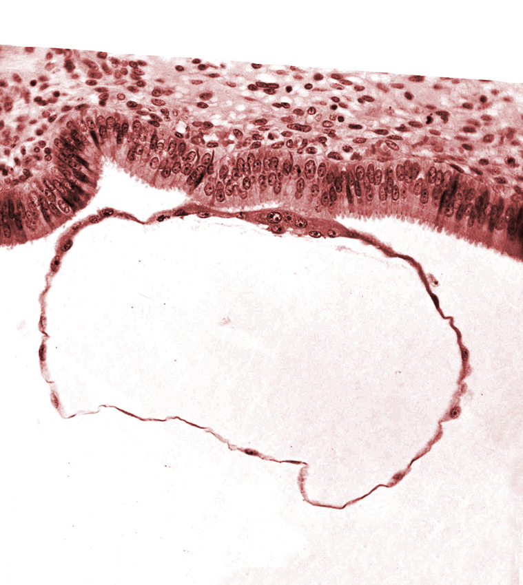 blastocystic cavity (blastocoele), edge of contact area, mural trophoblast