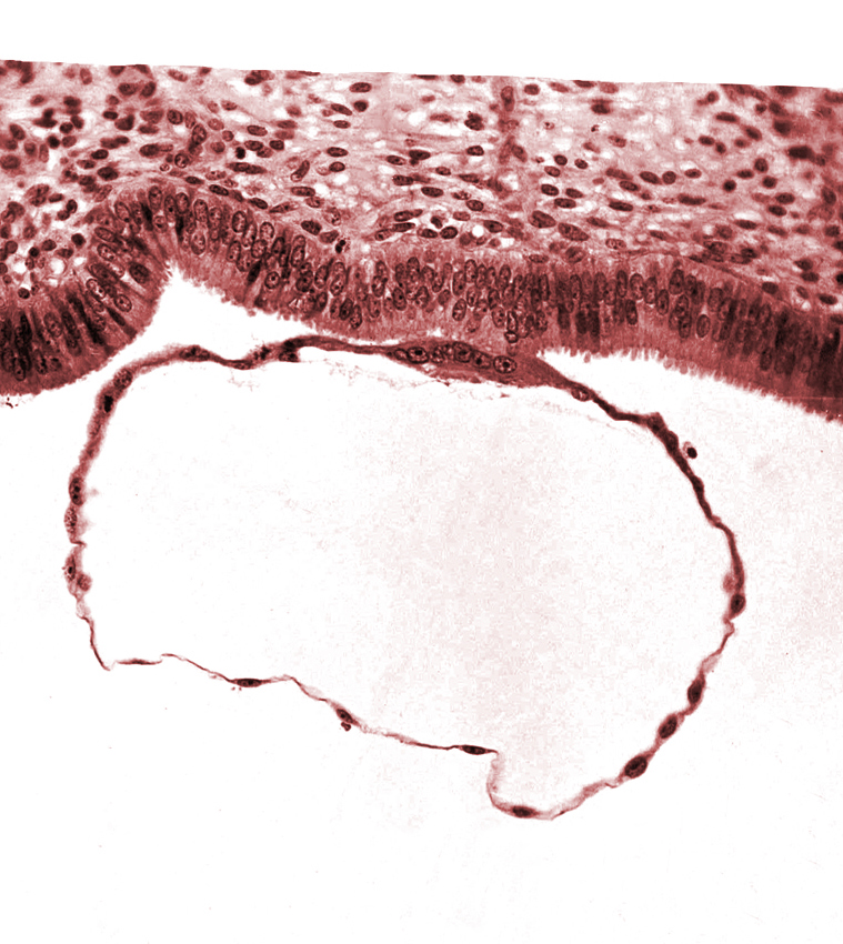 blastocystic cavity (blastocoele), contact area(s), edematous endometrial stroma (decidua), endometrial (uterine) epithelium, syncytiotrophoblast, uterine cavity