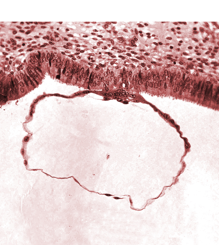 blastocystic cavity (blastocoele), cytotrophoblast, edematous endometrial stroma (decidua), mural trophoblast, syncytiotrophoblast