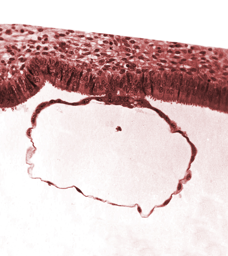 blastocystic cavity (blastocoele), contact area(s), uterine cavity