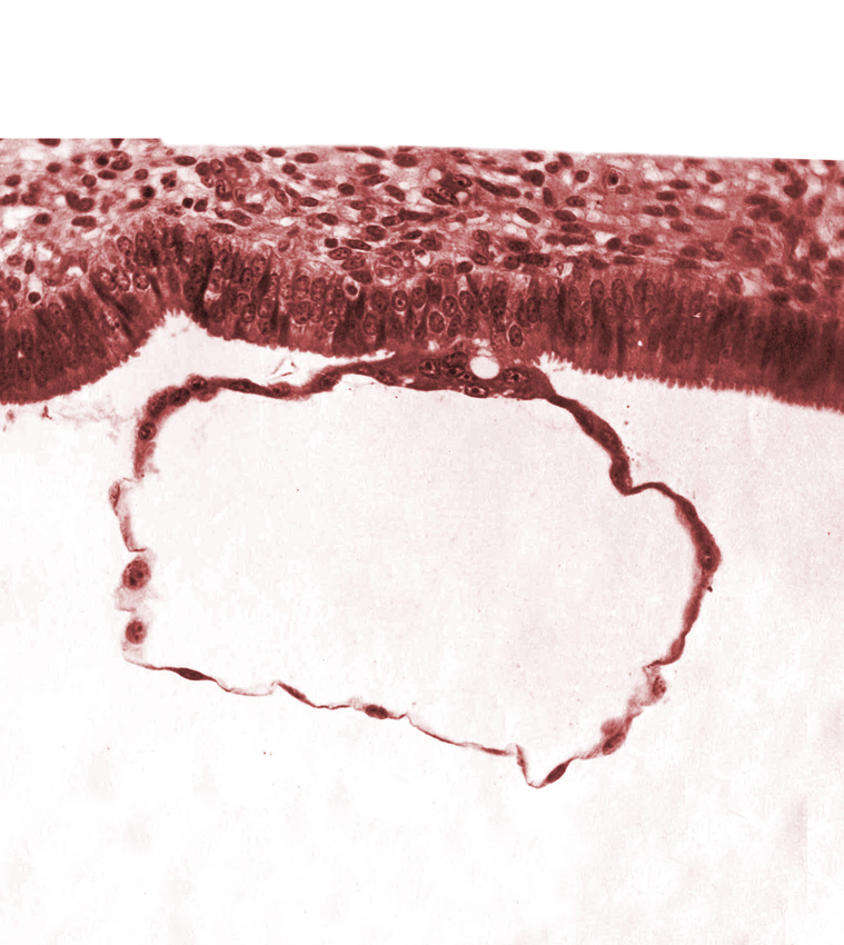 blastocystic cavity (blastocoele), edematous endometrial stroma (decidua), endometrial (uterine) stroma, gap in contact area, mural trophoblast