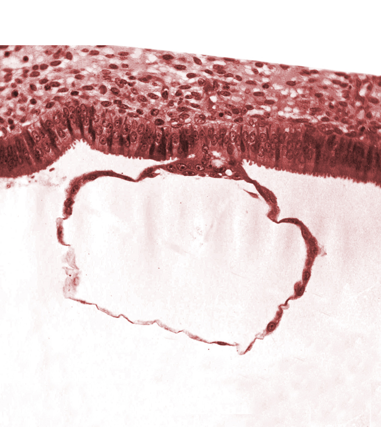 blastocystic cavity (blastocoele), contact area(s), edematous endometrial stroma (decidua), endometrial (uterine) epithelium, mural trophoblast