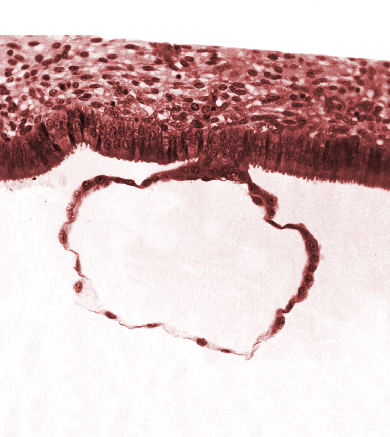 blastocystic cavity (blastocoele), contact area(s), edematous endometrial stroma (decidua), mural trophoblast