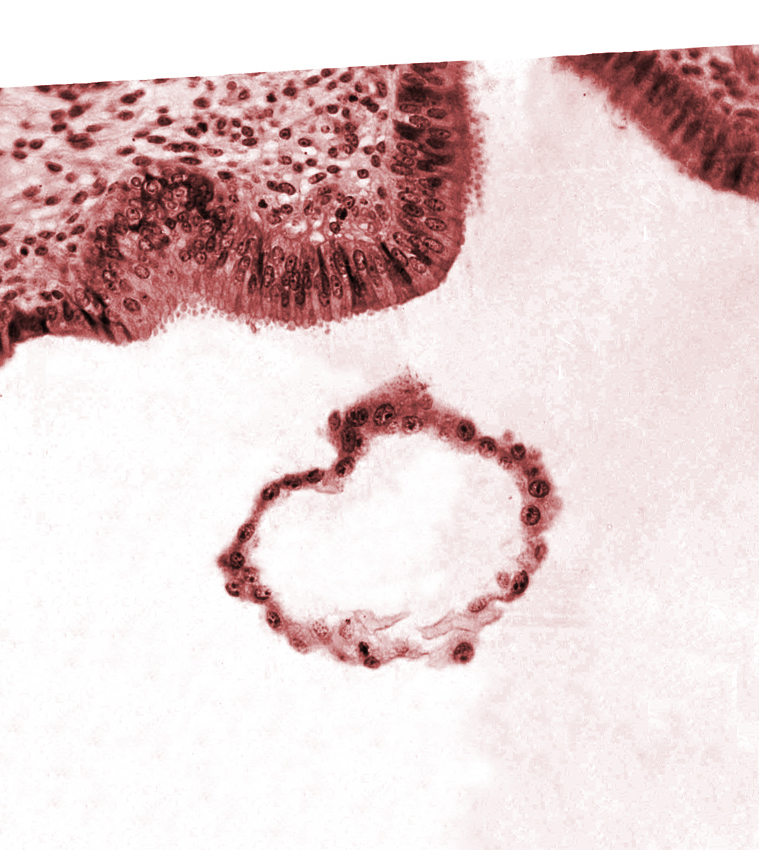 blastocystic cavity (blastocoele), tangentially cut mural trophoblast, uterine cavity