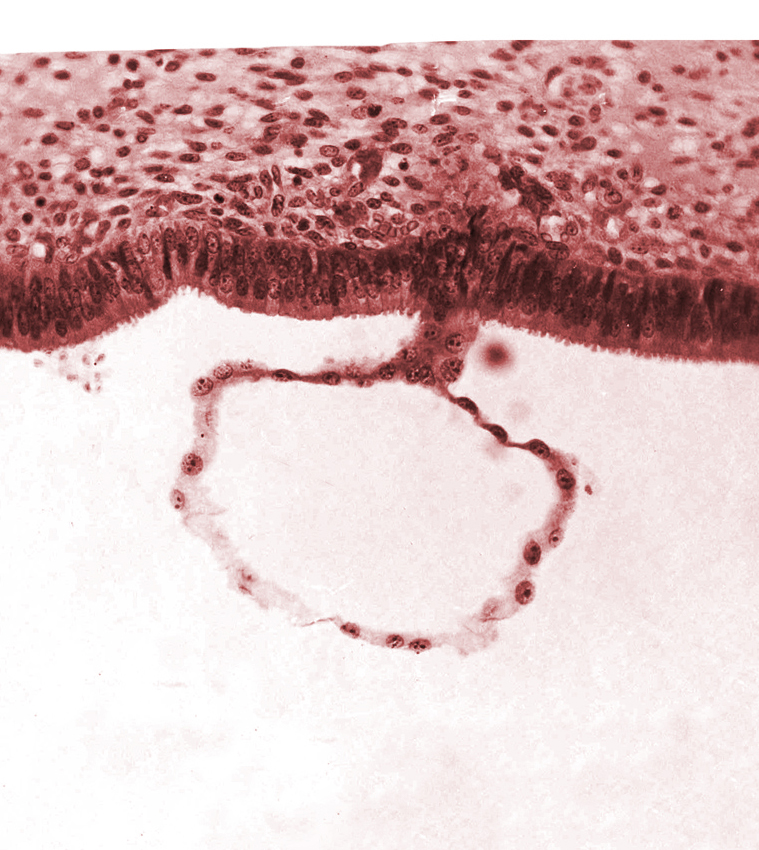 blastocystic cavity (blastocoele), edge of contact area, endometrial (uterine) epithelium, mural trophoblast, syncytiotrophoblast