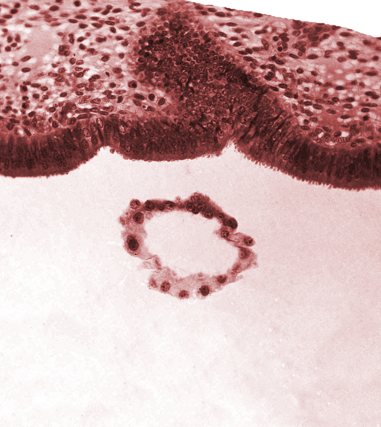 blastocystic cavity (blastocoele), endometrial (uterine) epithelium, endometrial (uterine) stroma, polar trophoblast, tangentially cut mural trophoblast