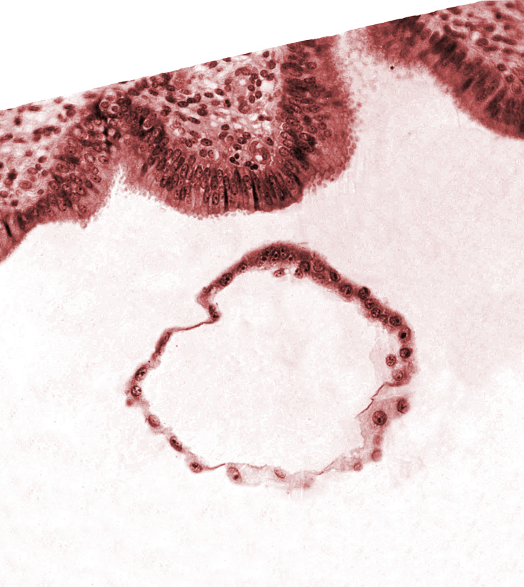 blastocystic cavity (blastocoele), mural trophoblast, uterine cavity