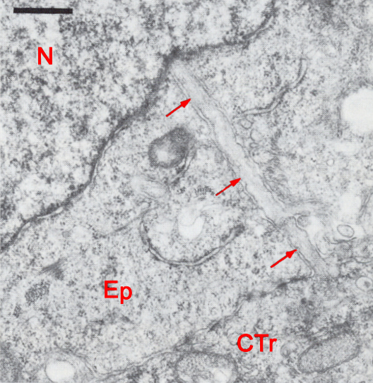 Long slender projection of a cytotrophoblast cell