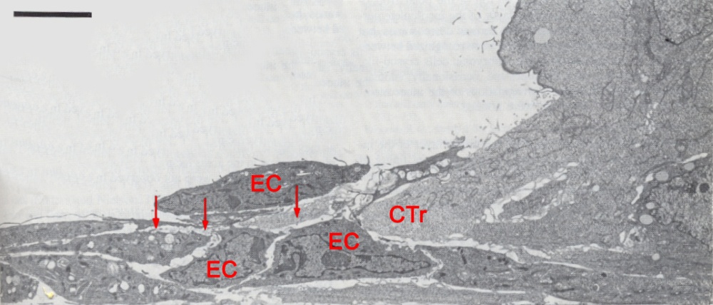 Details of the contact zone