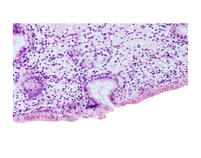 endometrial epithelium, lumen of endometrial gland, mouth of endometrial gland, solid syncytiotrophoblast