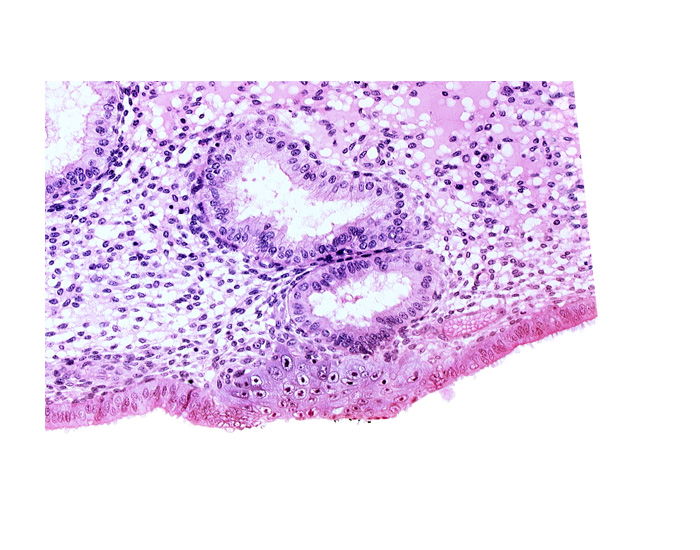 disrupted endometrial epithelium, edematous endometrial stroma (decidua), endometrial epithelium, endometrial gland, solid syncytiotrophoblast, uterine cavity