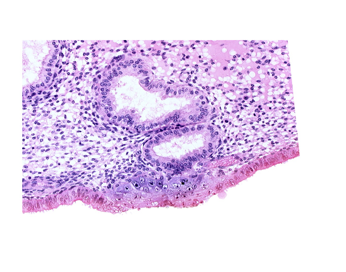 cytotrophoblast, edematous endometrial stroma (decidua), endometrial epithelium, endometrial gland, interrupted endometrial epithelium, solid syncytiotrophoblast, uterine cavity