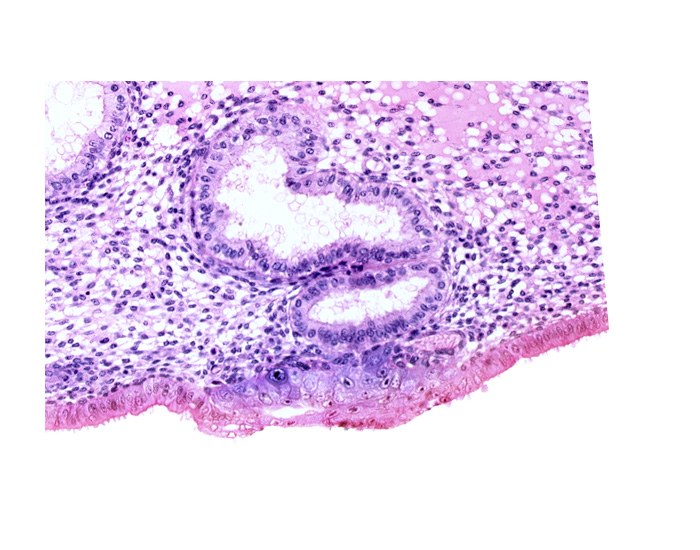 blastocystic cavity (blastocoele), cytotrophoblast, edematous endometrial stroma (decidua), endometrial epithelium, lumen of endometrial gland, solid syncytiotrophoblast