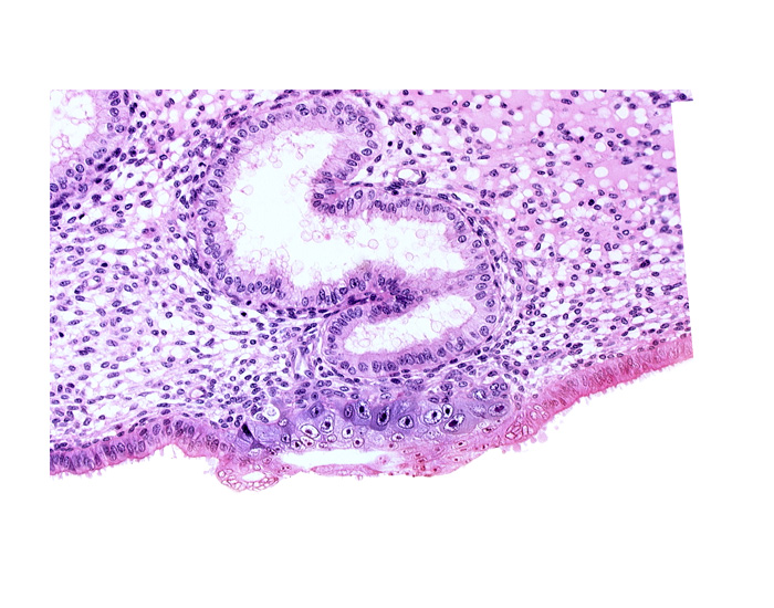 blastocystic cavity (blastocoele), cytotrophoblast, edematous endometrial stroma (decidua), endometrial gland, solid syncytiotrophoblast, syncytiotrophoblast / decidua interface, trophoblast