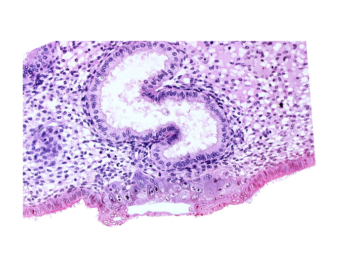 blastocystic cavity (blastocoele), cytotrophoblast, edematous endometrial stroma (decidua), endometrial sinusoid, solid syncytiotrophoblast, syncytiotrophoblast / decidua interface, trophoblast, uterine cavity