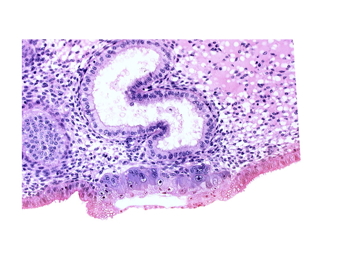blastocystic cavity (blastocoele), cytotrophoblast, endometrial epithelium, solid syncytiotrophoblast, trophoblast, uterine cavity