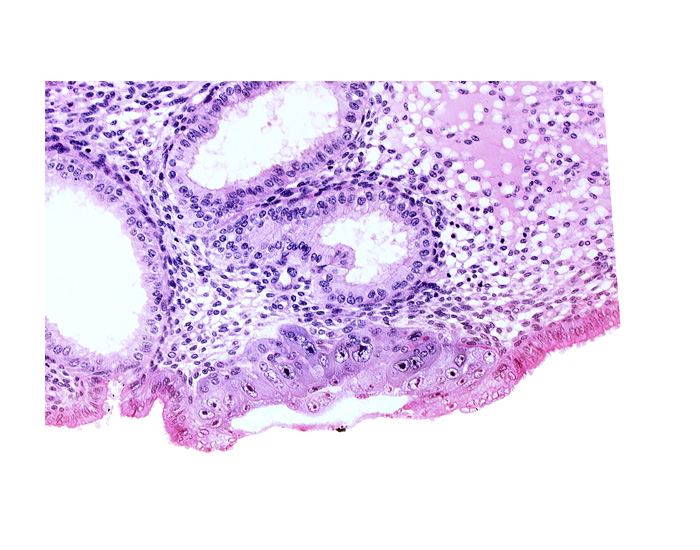 amniotic cavity, edematous endometrial stroma (decidua), embryonic disc, endometrial epithelium, extra-embryonic mesoblast, syncytiotrophoblast / decidua interface