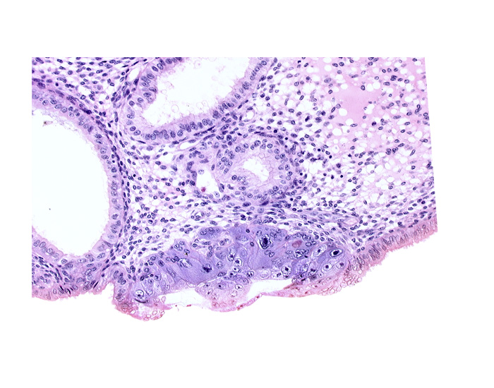 amniotic cavity, cytotrophoblast, endometrial gland, endometrial sinusoid, epiblast, hypoblast, syncytiotrophoblast / decidua interface
