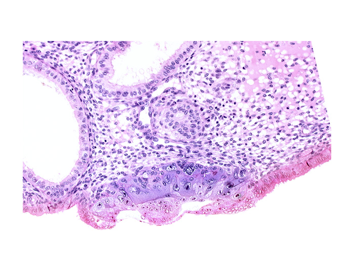 blastocystic cavity (blastocoele), endometrial epithelium, endometrial sinusoid, epiblast, hypoblast, membranous trophoblast at abembryonic pole