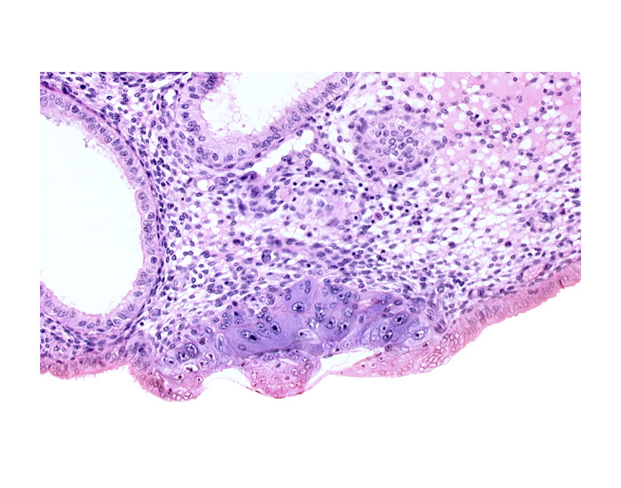 amniotic cavity, blastocystic cavity (blastocoele), embryonic disc, endometrial epithelium, endometrial sinusoid, membranous trophoblast at abembryonic pole