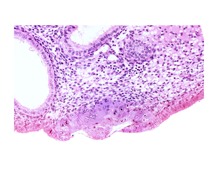 amniotic cavity, blastocystic cavity (blastocoele), edematous endometrial stroma (decidua), endometrial epithelium, lumen of endometrial gland, membranous trophoblast at abembryonic pole