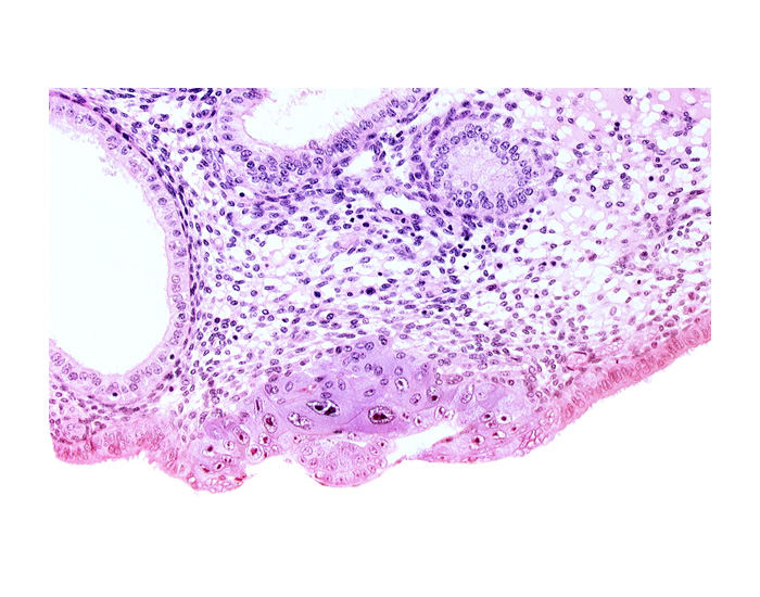 amniotic cavity, blastocystic cavity (blastocoele), cytotrophoblast, embryonic disc, endometrial gland, endometrial sinusoid, solid syncytiotrophoblast, uterine cavity