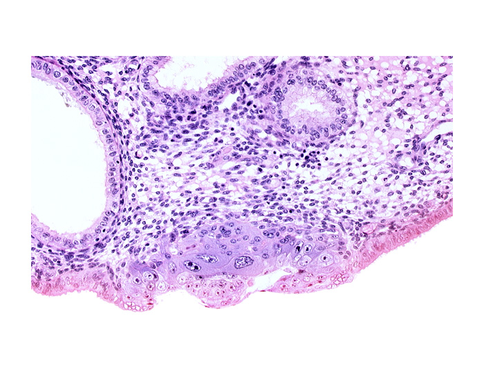 amniotic cavity, blastocystic cavity (blastocoele), embryonic disc, endometrial sinusoid, membranous trophoblast at abembryonic pole, solid syncytiotrophoblast, syncytiotrophoblast / decidua interface