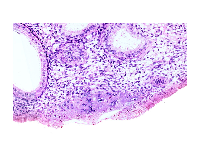 amniotic cavity, blastocystic cavity (blastocoele), cytotrophoblast, embryonic disc, endometrial gland, endometrial sinusoid, lumen of endometrial gland, membranous trophoblast at abembryonic pole