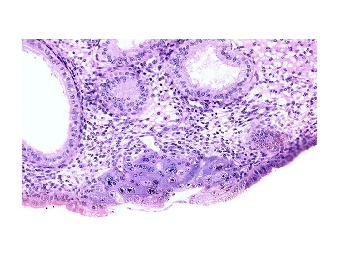amniotic cavity, blastocystic cavity (blastocoele), endometrial sinusoid, epiblast, extra-embryonic mesoblast, hypoblast, membranous trophoblast at abembryonic pole