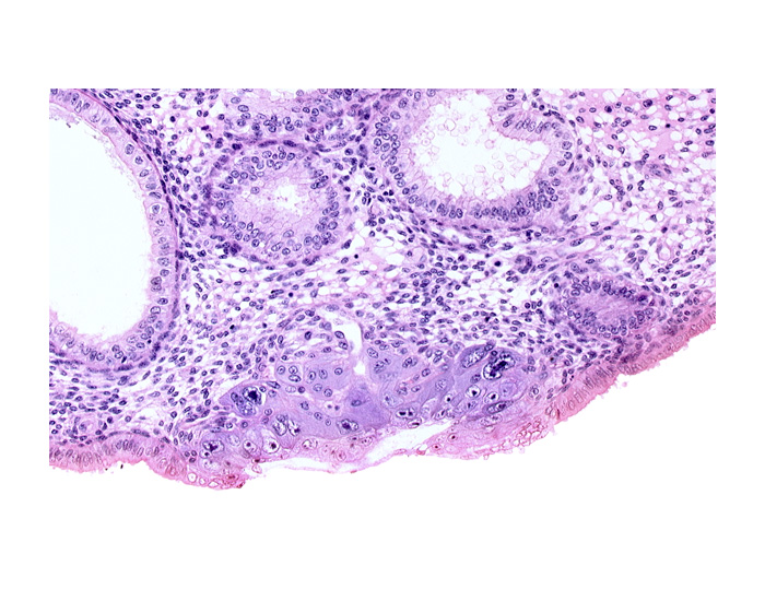 blastocystic cavity (blastocoele), edematous endometrial stroma (decidua), embryonic disc, endometrial gland, endometrial sinusoid, membranous trophoblast at abembryonic pole