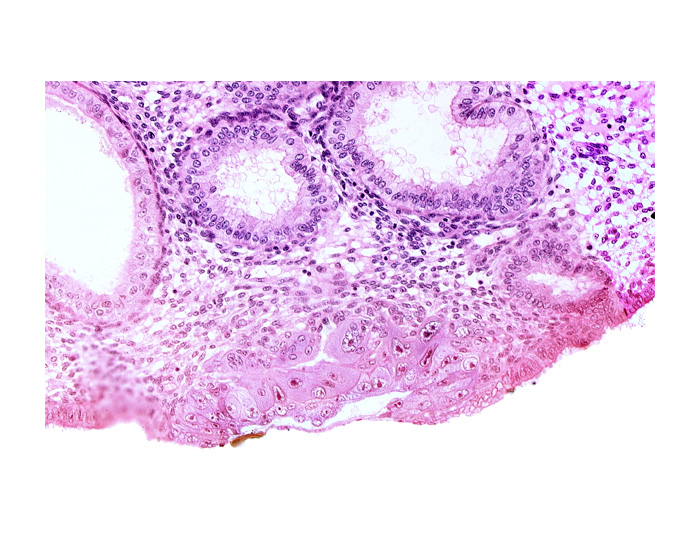 blastocystic cavity (blastocoele), cytotrophoblast, embryonic disc, endometrial sinusoid, extra-embryonic mesoblast, membranous trophoblast at abembryonic pole, solid syncytiotrophoblast