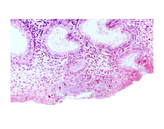 blastocystic cavity (blastocoele), endometrial gland, extra-embryonic mesoblast, lumen of endometrial gland, membranous trophoblast at abembryonic pole, mouth of endometrial gland, uterine cavity