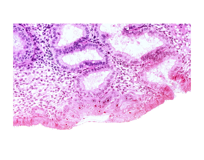 blastocystic cavity (blastocoele), endometrial epithelium, endometrial gland, membranous trophoblast at abembryonic pole, mouth of endometrial gland, solid syncytiotrophoblast, uterine cavity