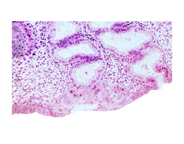 blastocystic cavity (blastocoele), endometrial epithelium, membranous trophoblast at abembryonic pole, solid syncytiotrophoblast