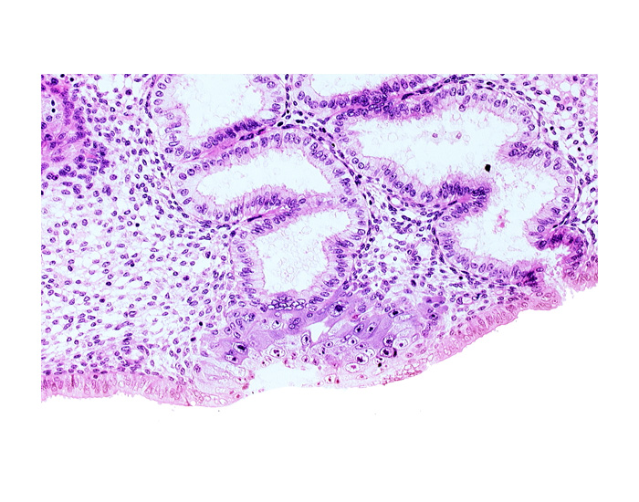 blastocystic cavity (blastocoele), cytotrophoblast, endometrial epithelium, endometrial sinusoid, junction of endometrial gland and syncytiotrophoblast, membranous trophoblast at abembryonic pole, space(s) within syncytiotrophoblast