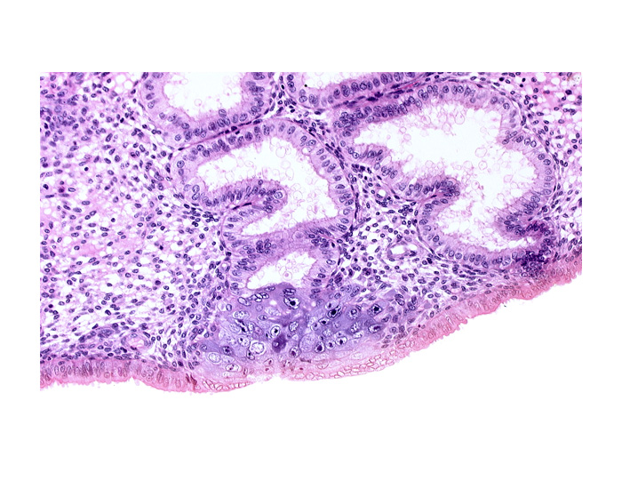 cytotrophoblast, edge of membranous trophoblast at abembryonic pole, endometrial epithelium, lumen of endometrial gland, solid syncytiotrophoblast, syncytiotrophoblast engulfing wall of endometrial gland, uterine cavity