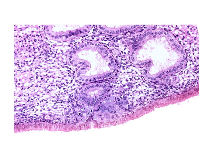 endometrial epithelium, endometrial gland, endometrial sinusoid, solid syncytiotrophoblast, syncytiotrophoblast engulfing endometrial gland cells